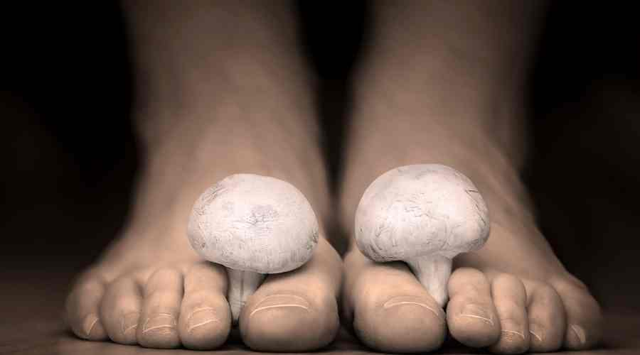 manchas blancas en las uñas de los piesBúsqueda de TikTok