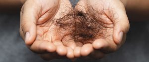 Tratamiento para la caída del pelo | Farmacia del Sagrario